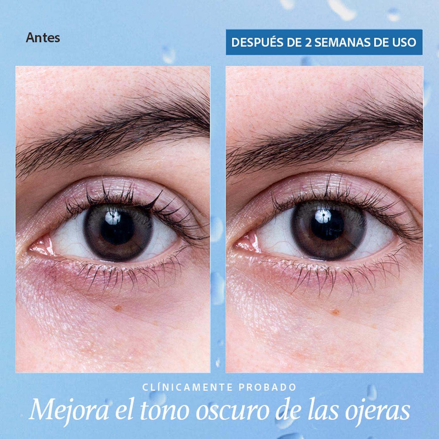 gel-antiojeras-contorno-de-ojos-belif-aqua-bomb-revitalizador-15-mljpg_1500x1500_63150056