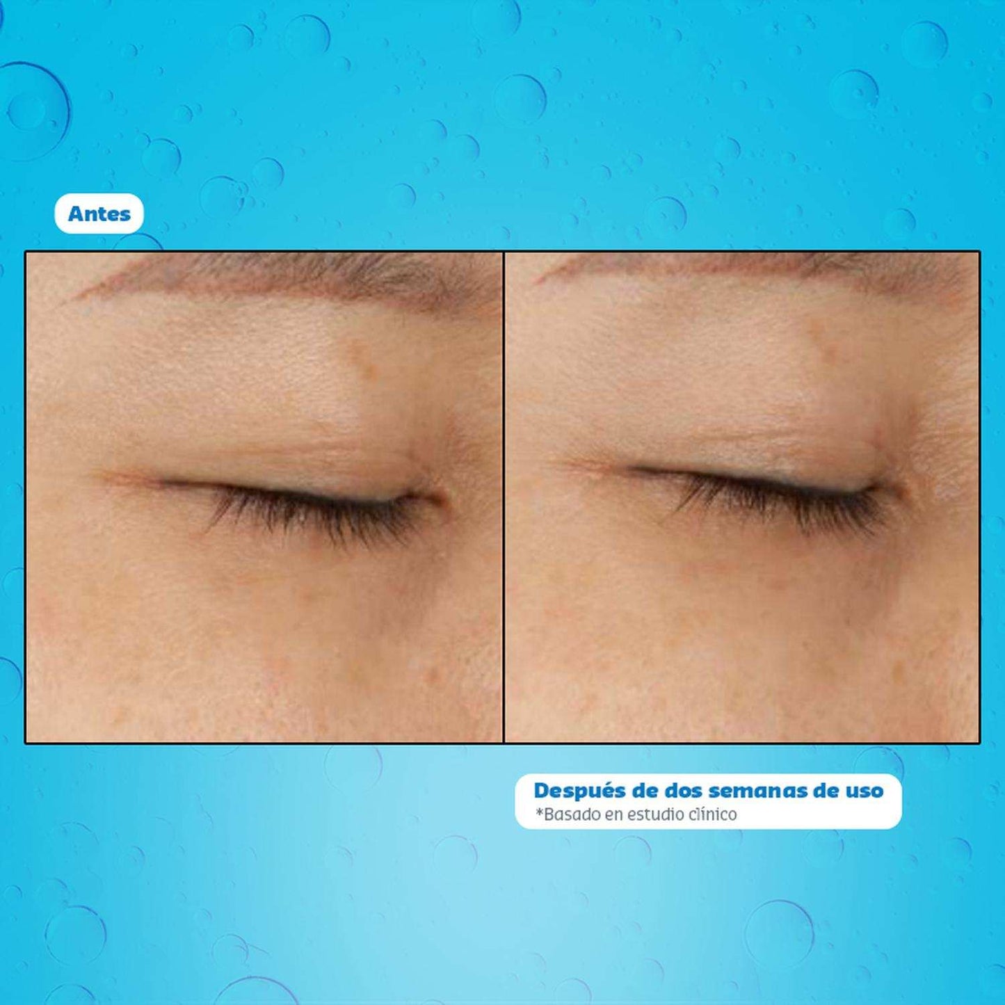 antiojeras_1500x1500_63468483