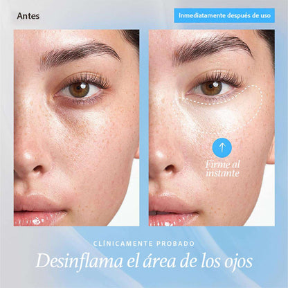 gel-antiojeras-contorno-de-ojos-belif-aqua-bomb-revitalizador-15-mljpg_1500x1500_63150055